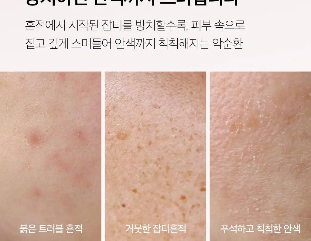 [쿨링광채]메디큐브 PDRN 핑크 콜라겐 토닝 겔 토너패드 70매 기획(본품70매+겔패드10매) 상세페이지 40